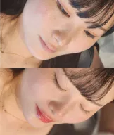 写真４
